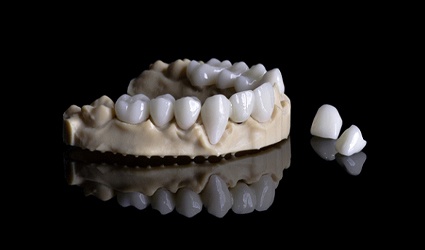 a model of a mouth with customized crowns sitting next to it