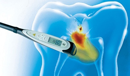 Laser cavity detection software on computer